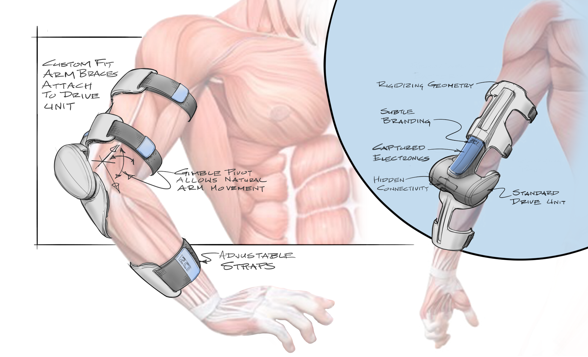 Second Chance Device Model 2