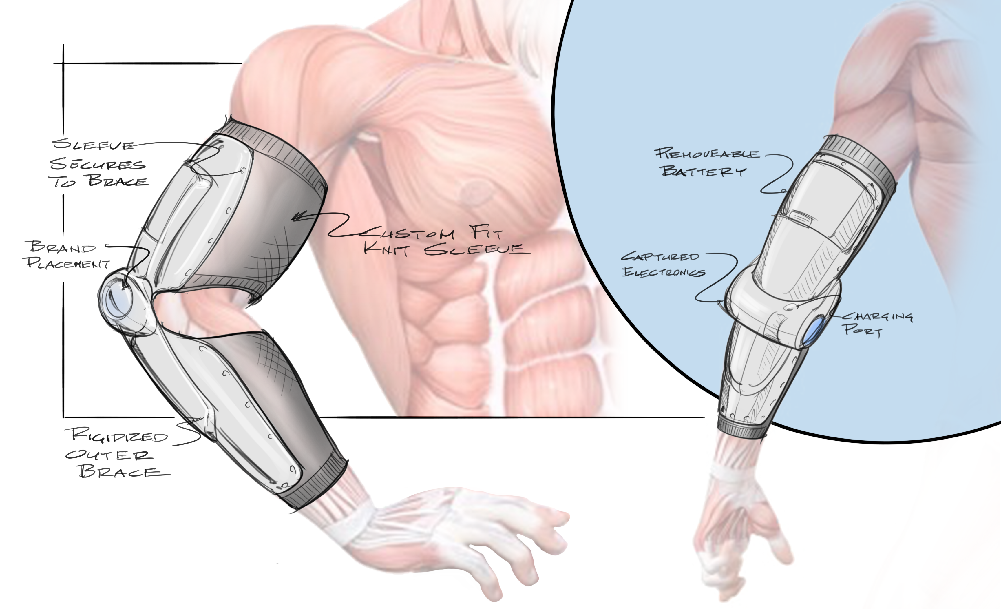 Second Chance Device Model 3